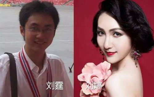 鞠婧祎整容过吗真实答案 鞠婧祎整容过吗真实答案